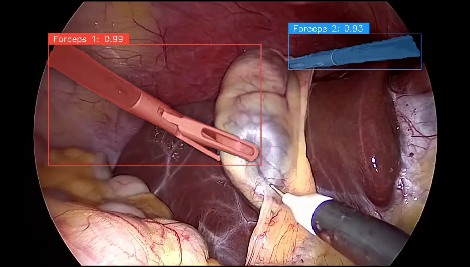 Deep Learning-Assisted Laparoscopic Surgery